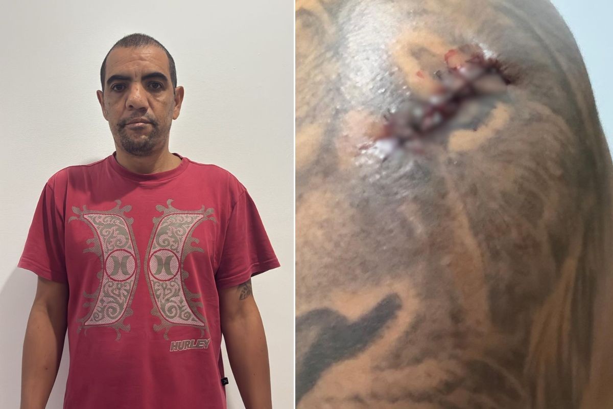 Homem é esfaqueado por assaltante durante passeio com cachorro no litoral de SP