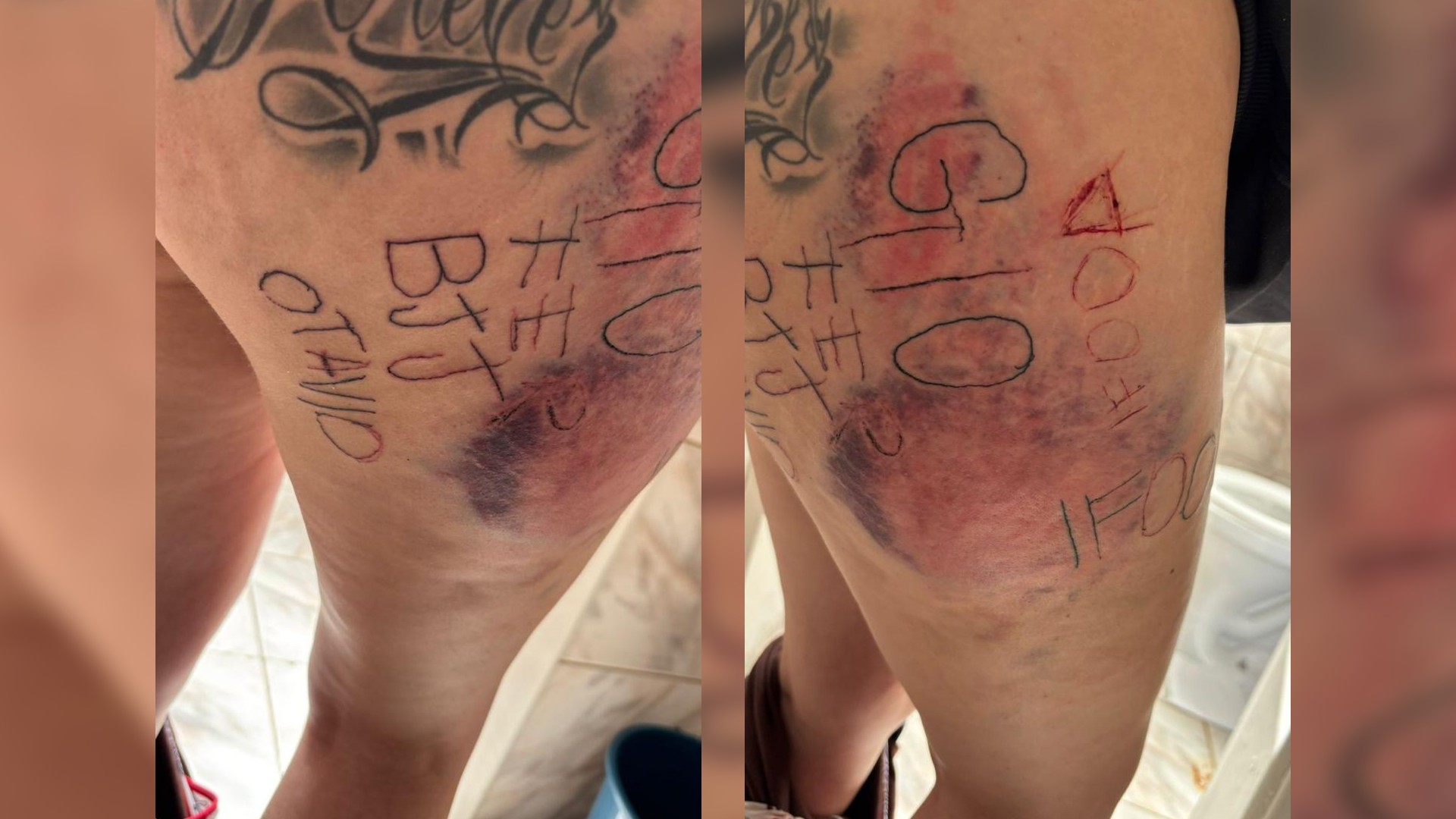 Jovem torturada e tatuada à força pelo namorado foi agredida enquanto dormia: 'Só pensava em fugir', diz advogado