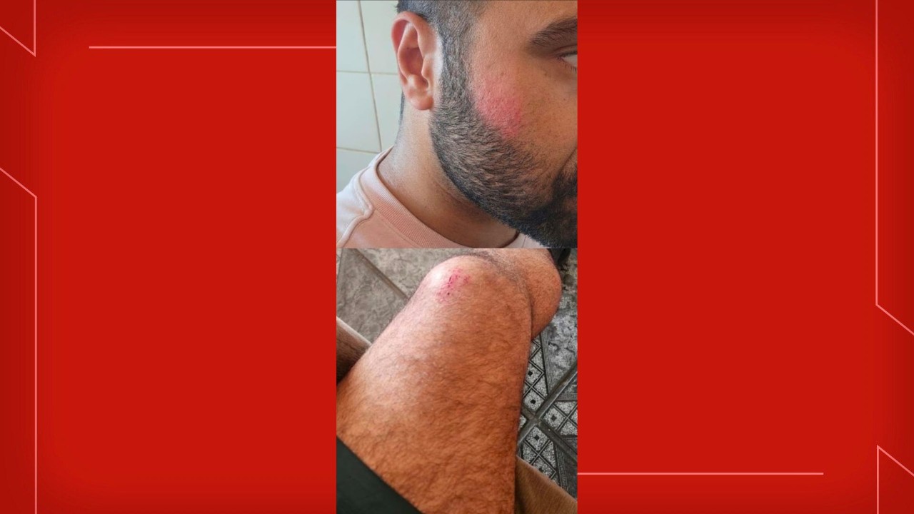 Eleitor no DF relata ter sido agredido após 'fazer o L' para uma amiga em área pública neste domingo