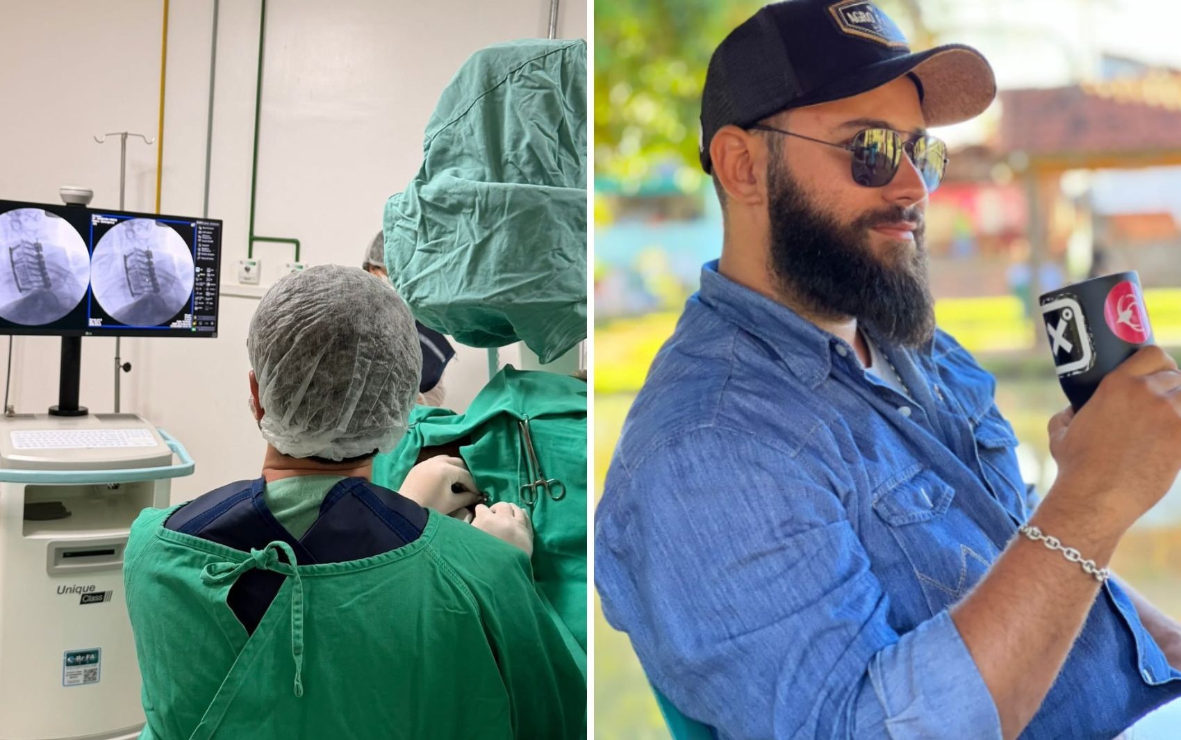 Paciente que ficou tetraplégico após acidente recebe polilaminina em hospital de Itumbiara