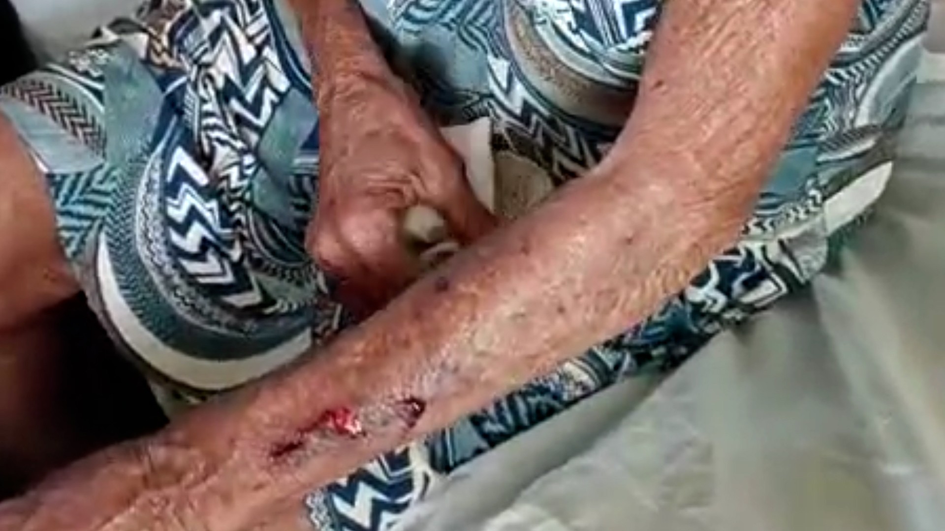 Idosa de 79 anos sofre tentativa de estupro durante pesca na zona rural de Codó, no MA