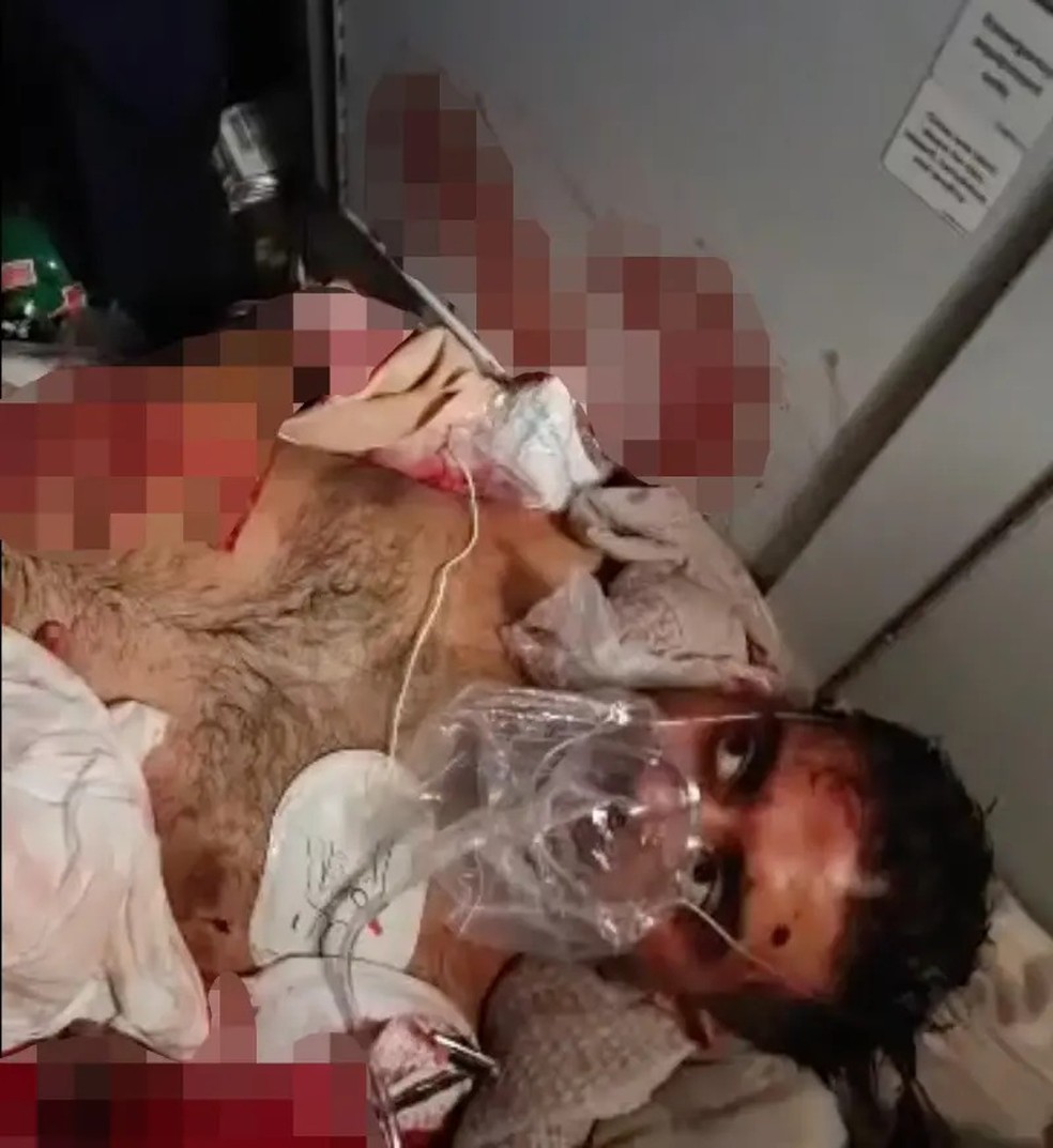 O piloto Smit Machchhar ferido após o ataque — Foto: Reprodução: Redes Sociais