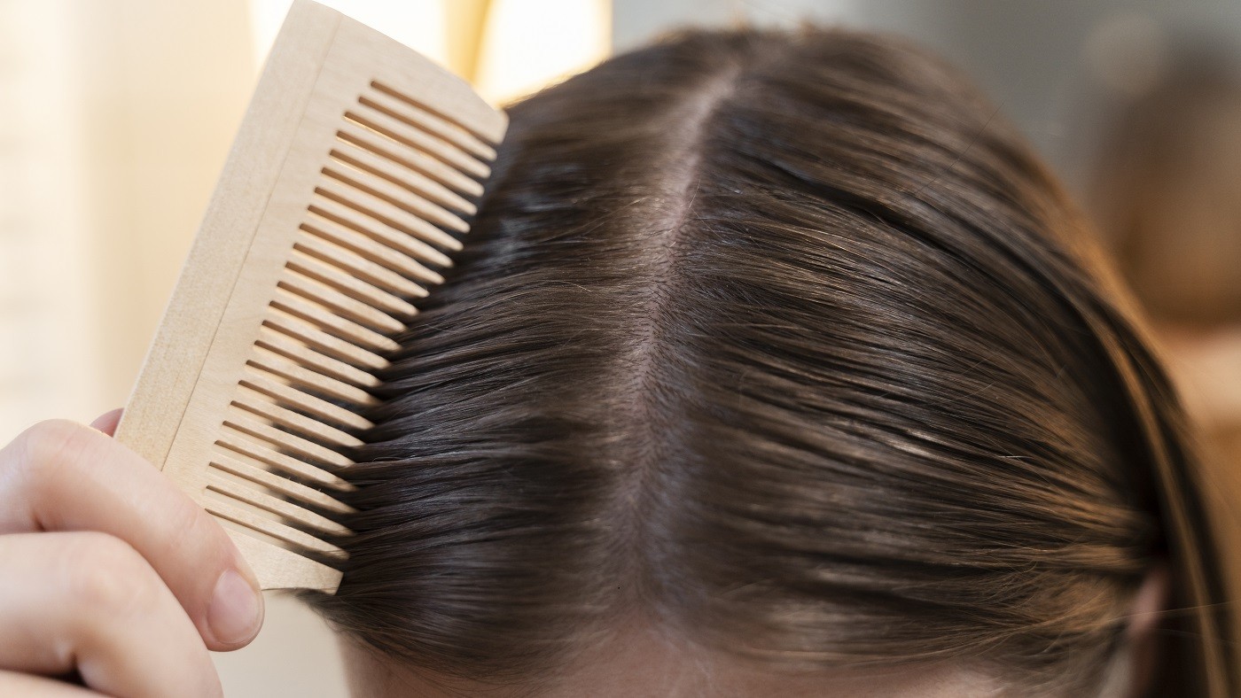 Oleosidade excessiva? Aprenda a tratar e equilibrar o couro cabeludo