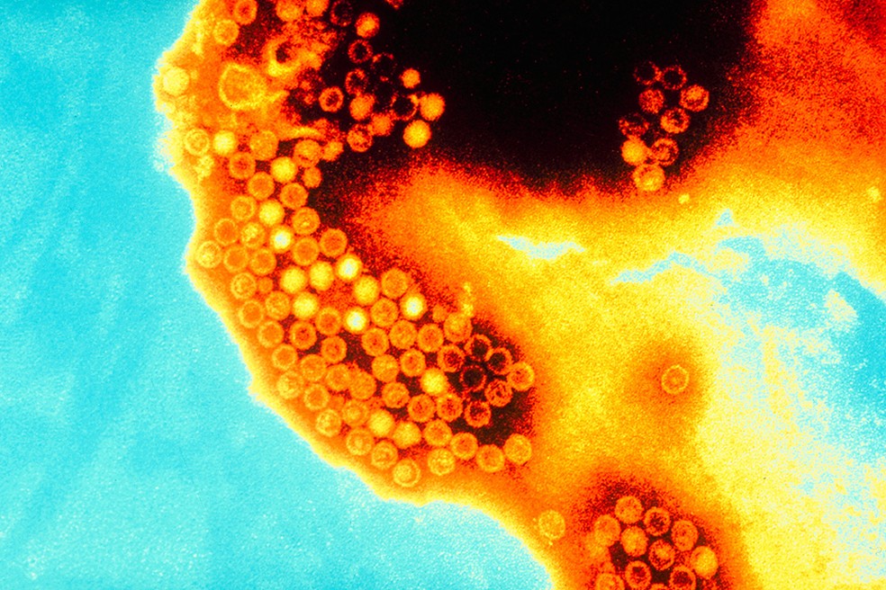 O vírus da Hepatite A (HVA) causa inflamação aguda no fígado e é a forma mais comum de hepatite viral. — Foto: Alain Grillet-Sanofi Pasteur