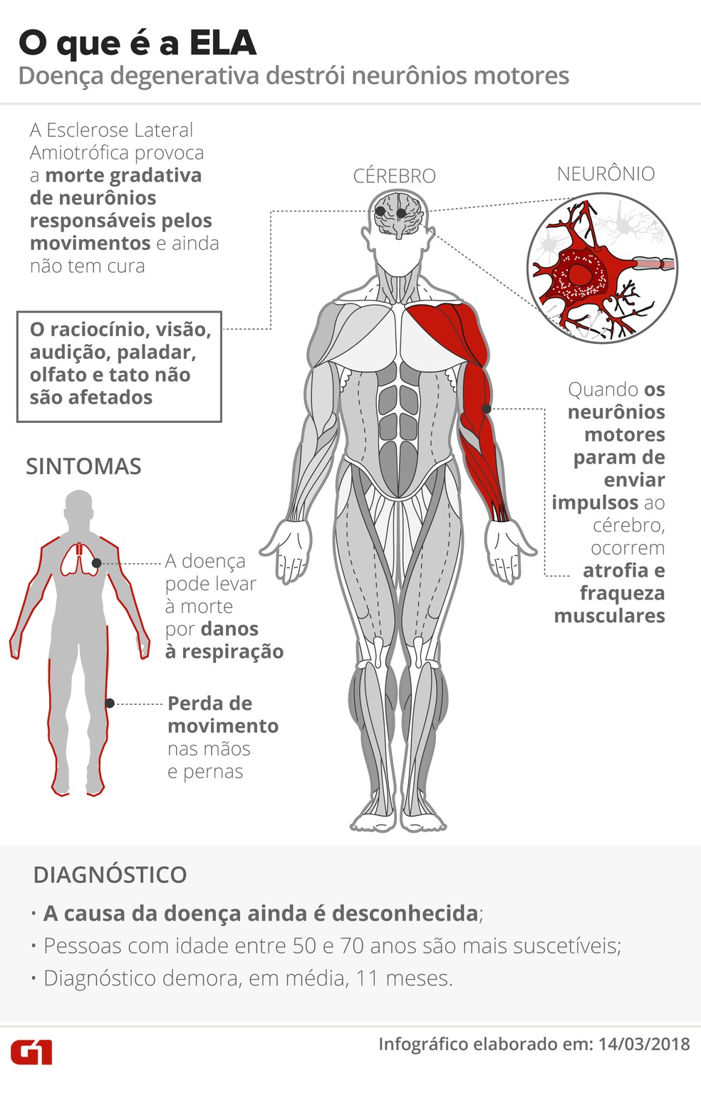 Esclerose Lateral Amiotrófica — Foto: Infografia: Karina Almeida/G1