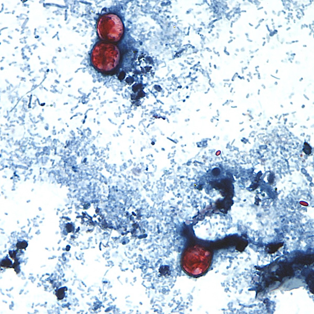 Estados Unidos registram surto de ciclosporíase com mais de 2,8 mil pessoas diagnosticadas