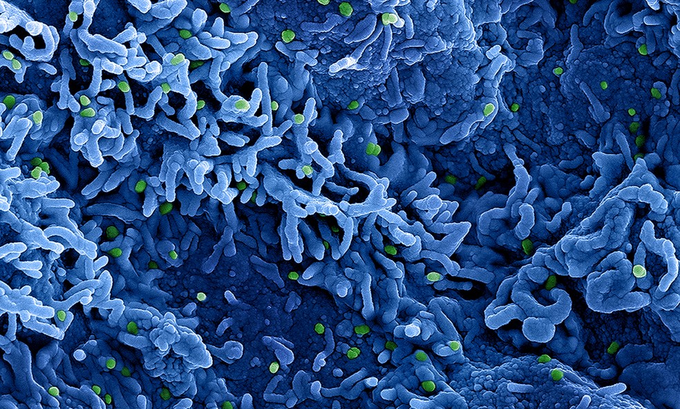 MPXV: Como é o vírus da mpox, um dos maiores e mais resistentes vírus de  DNA; veja infográficos | Saúde | G1
