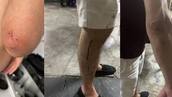 Estudante de medicina é investigado após agredir casal gay e simular masturbação em bar — Foto: Reprodução