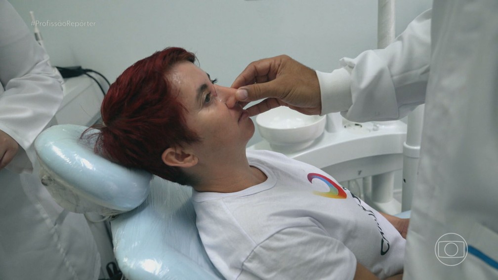 Andreia da Silva recebeu uma prótese após ter câncer de pele no nariz — Foto: Reprodução/TV Globo