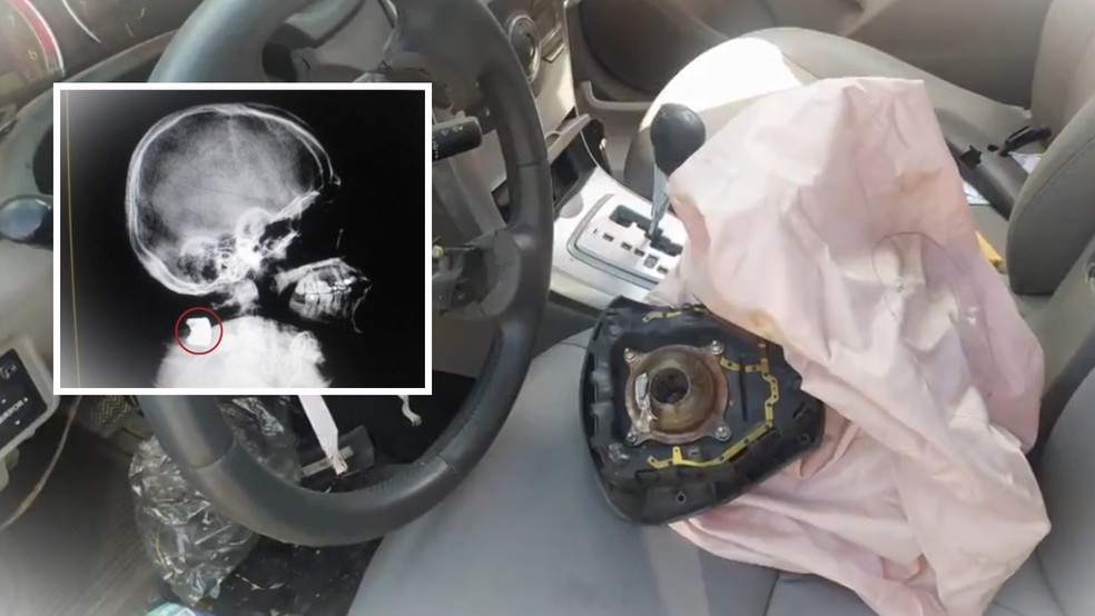 Um homem de 38 anos morreu em setembro de 2022, em Fortaleza, após ter o pescoço perfurado pela peça do insuflador do sistema do airbag do carro. — Foto: TV Globo/  Produção