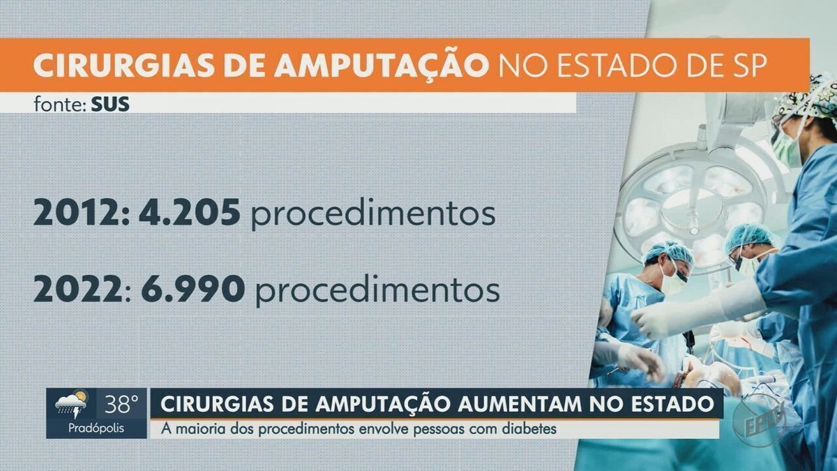 Le diabète est à l’origine de la majorité des opérations d’amputation dans le SUS de SP : pourquoi la maladie peut-elle s’aggraver à ce point ?  |  Ribeirão Preto et Franca
