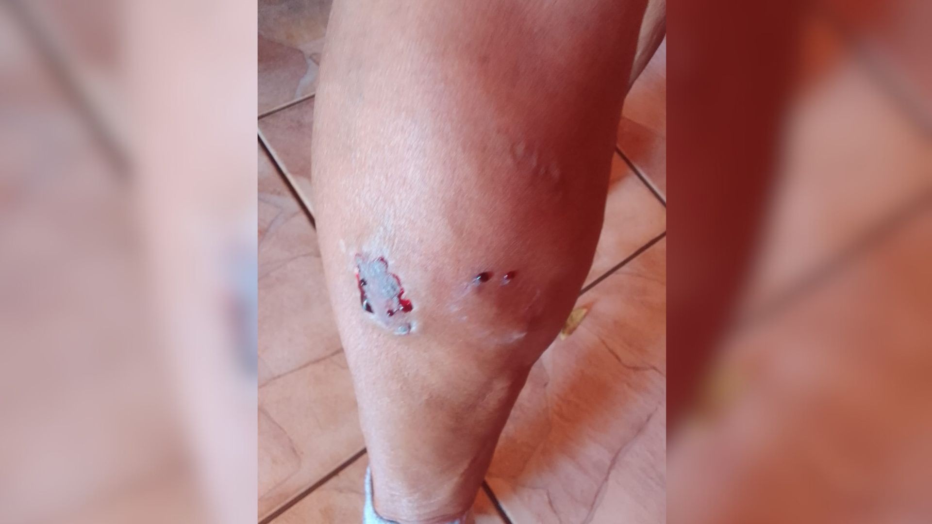 Idosa fica ferida após ser mordida por cão do vizinho em cidade do interior de São Paulo