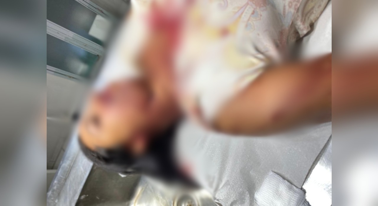 Mulher é agredida com barra de ferro em Pontalinda; ex-namorado é suspeito