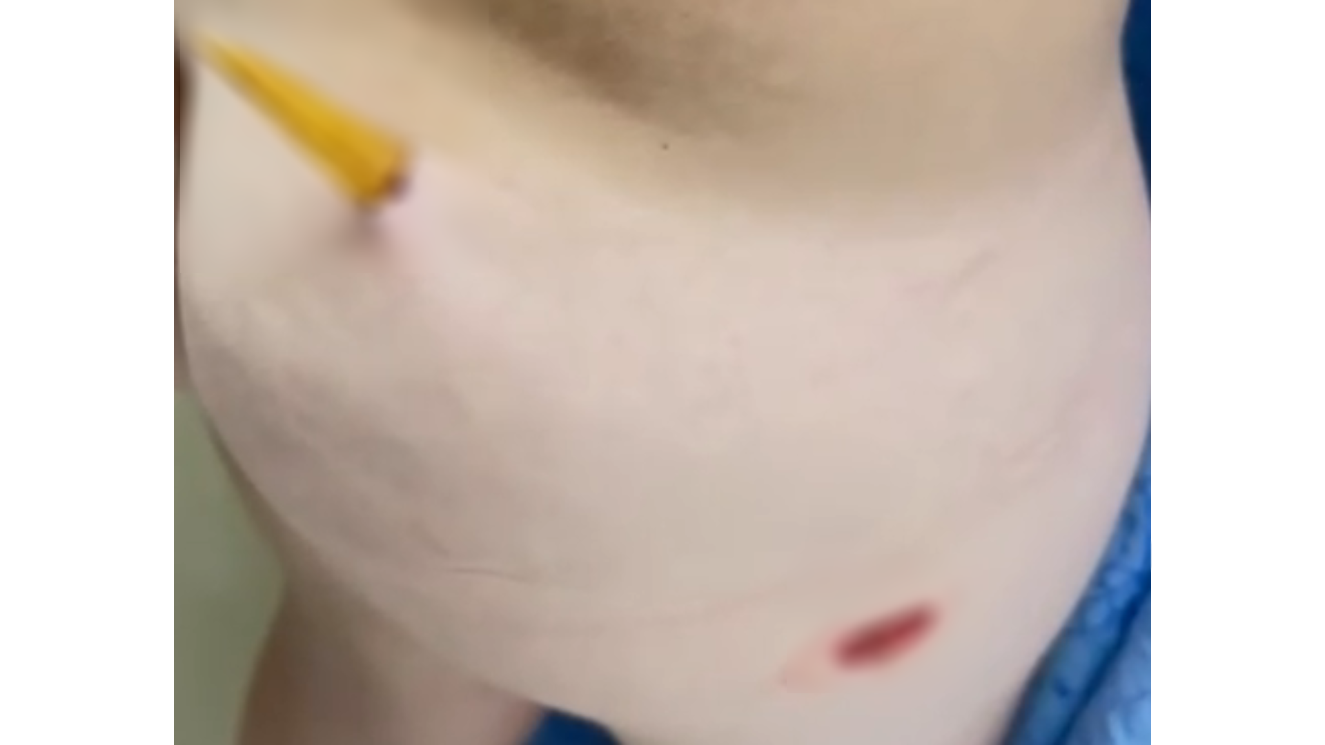 Pedaço de madeira se solta do palco do Teatro Guaíra e atravessa perna de criança durante ensaio, em Curitiba