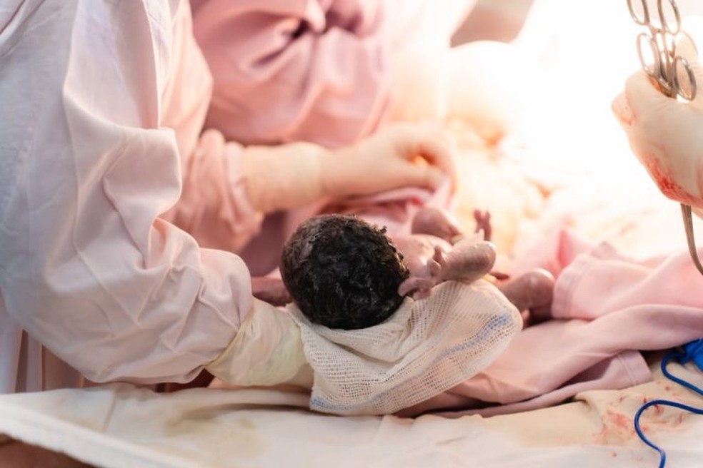 Hospital de Jo&atilde;o Pessoa realiza primeiro parto de quadrig&ecirc;meos; m&atilde;e &eacute; africana e fala franc&ecirc;s &mdash; Foto: Reprodu&ccedil;&atilde;o / Prefeitura de Jo&atilde;o Pessoa