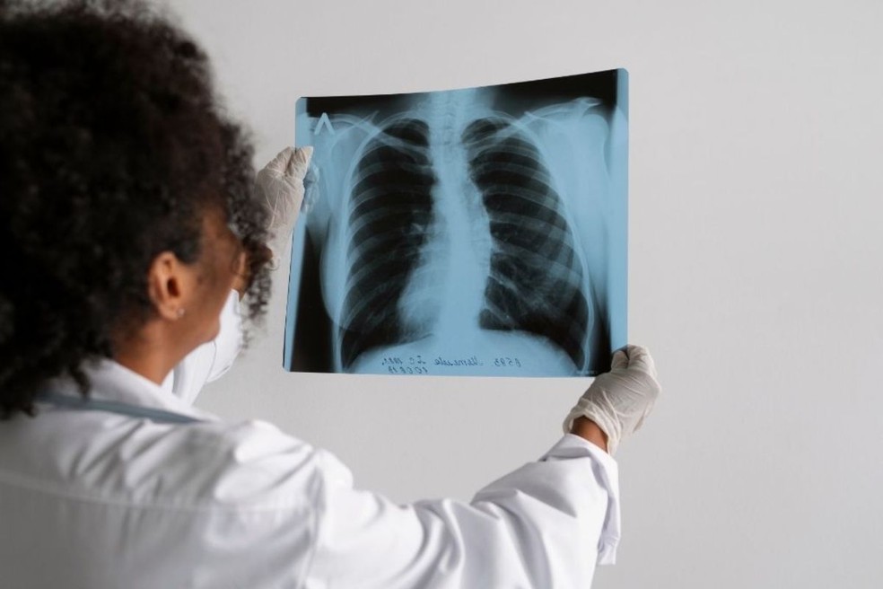 Tuberculose aumenta no Brasil desde 2015. — Foto: Divulgação/Prefeitura de São Vicente