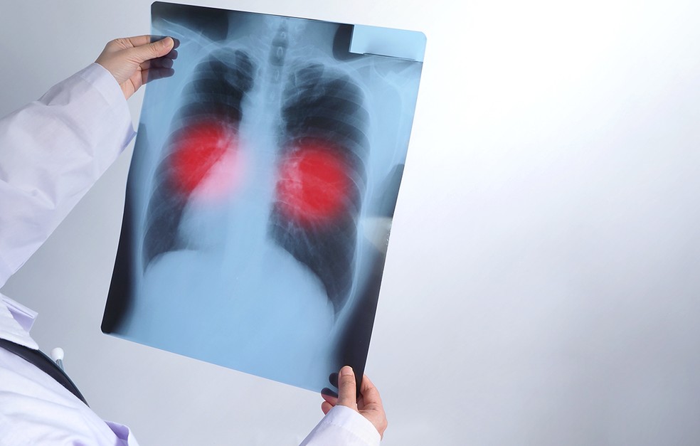 Passos já registrou três mortes e 28 casos de tuberculose em 2023 — Foto: Freepik 
