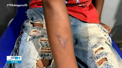 Homem é suspeito de usar ferro de marcar em criança indígena na Ilha do Bananal