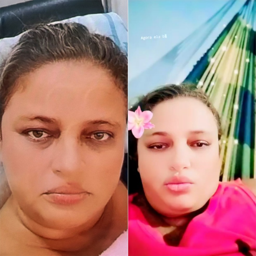 Mariv&acirc;nia era paciente renal da Cl&iacute;nica de Di&aacute;lise de Mossor&oacute; &mdash; Foto: Cedidas