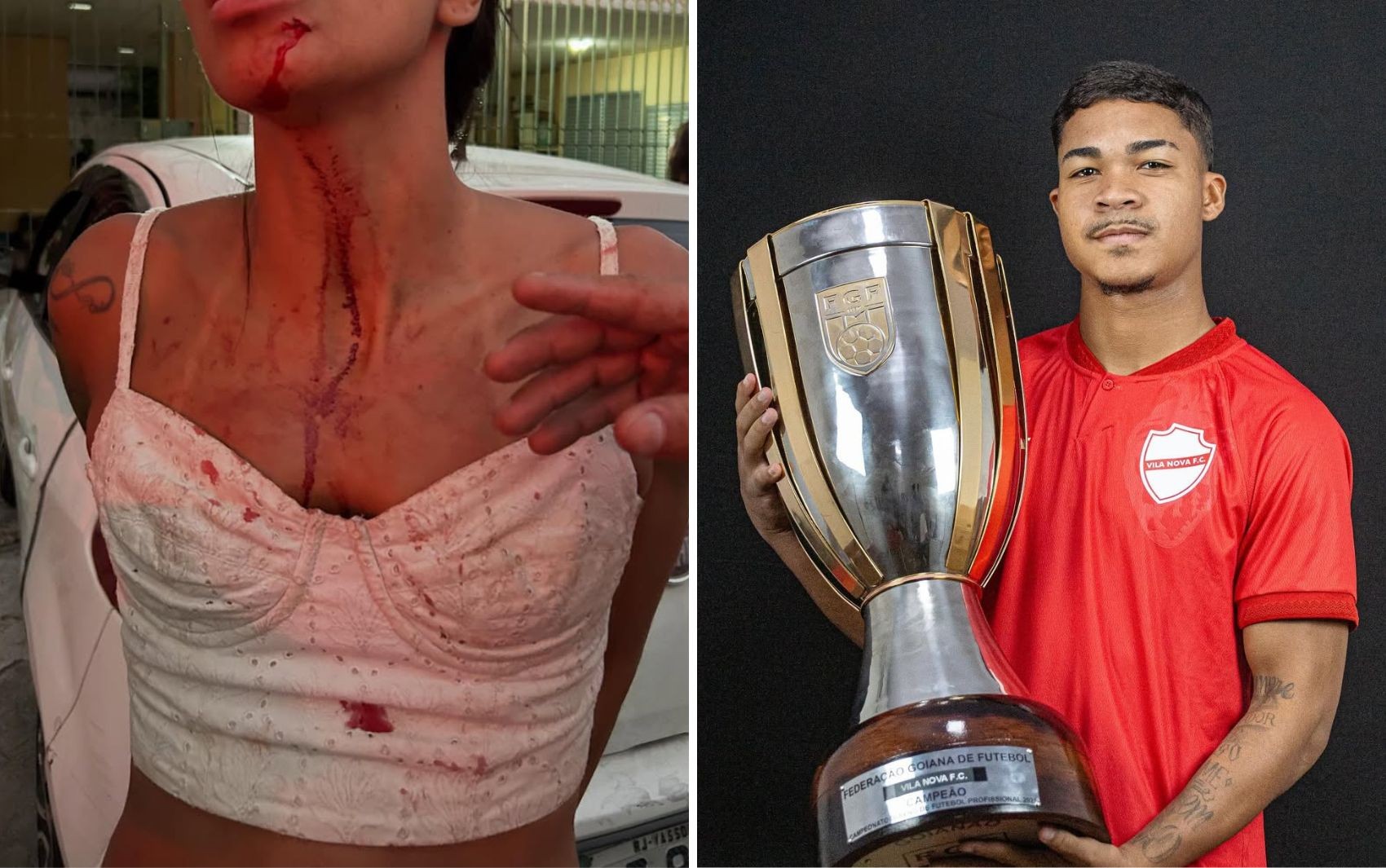 Mulher denuncia agressão contra jogador do Vila Nova; atacante nega