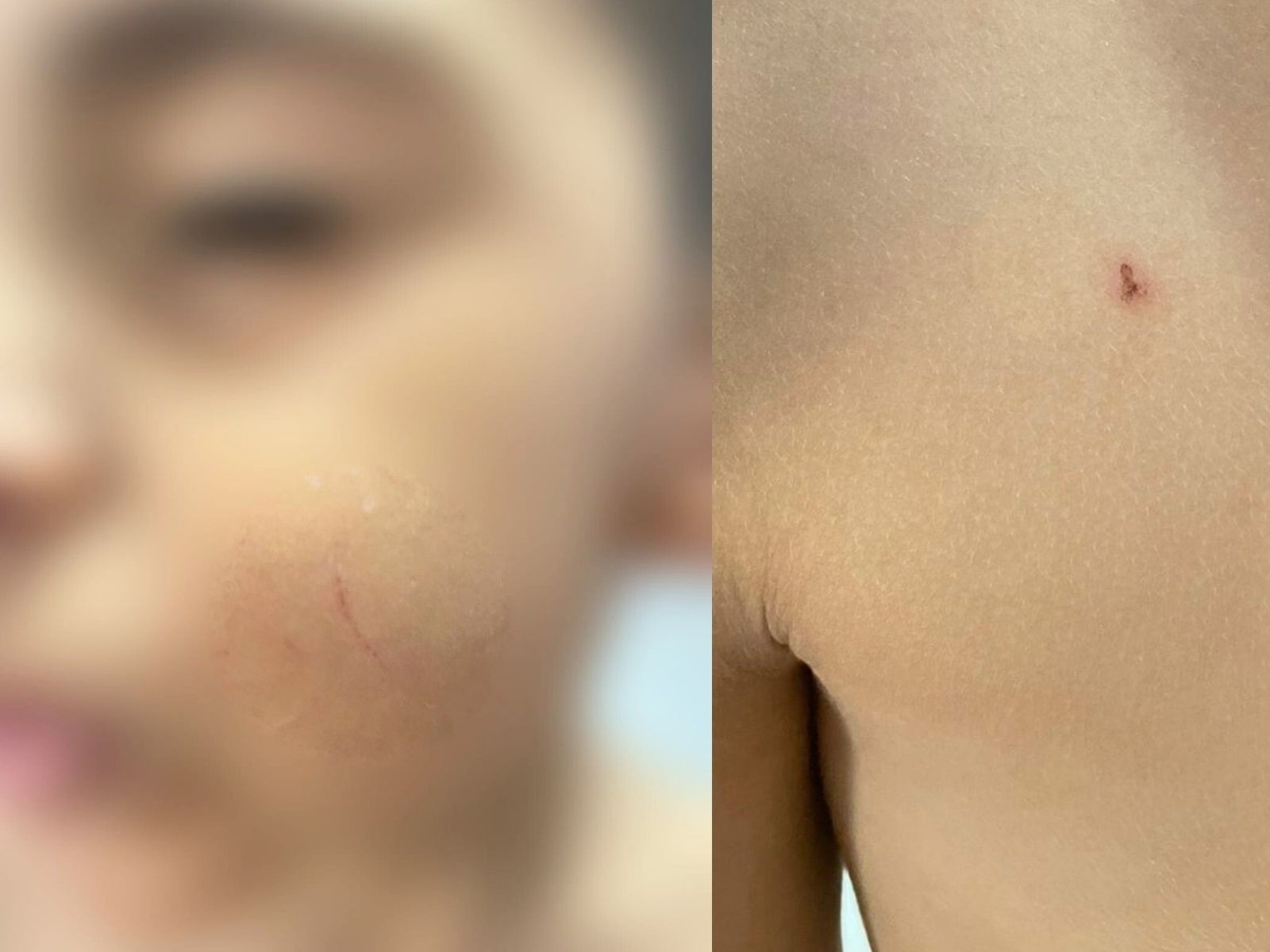 Mãe denuncia que filho de 4 anos foi banhado à força durante crise nervosa em escola no interior do AC