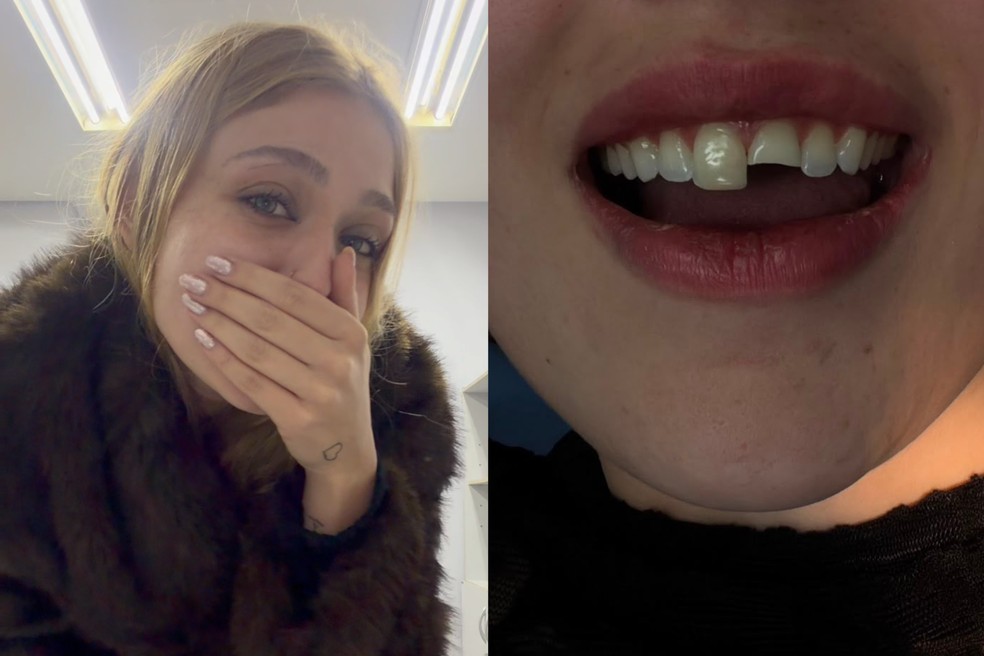 Jovem quebra dente na balada, procura dentista de madrugada e volta para terminar a festa no Paraná — Foto: Redes sociais