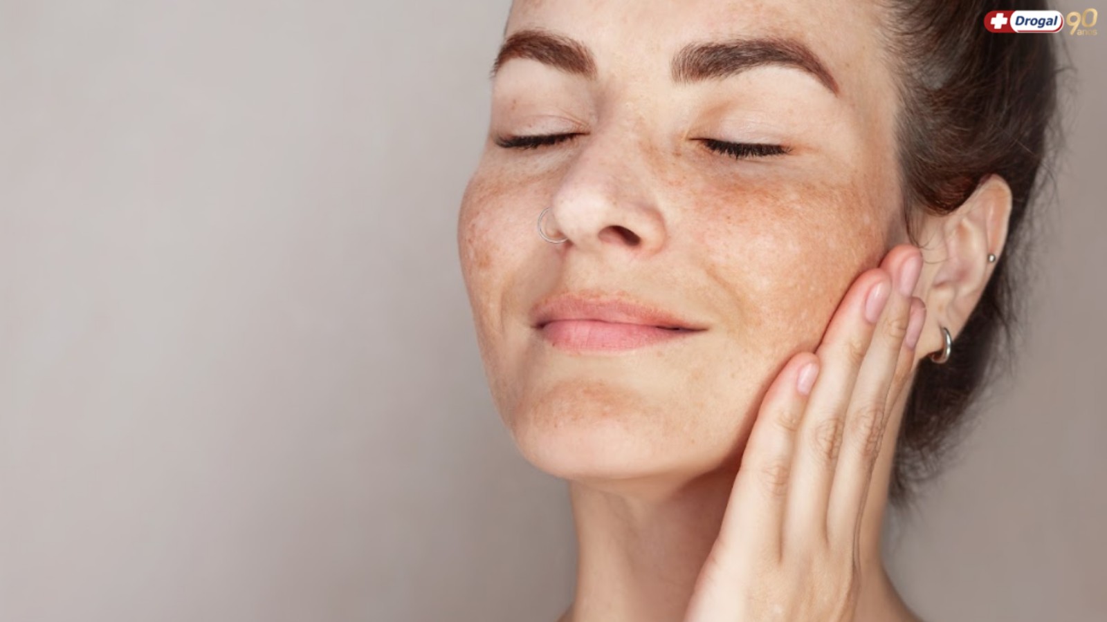 Melhores tratamentos para melasma: o que realmente funciona?