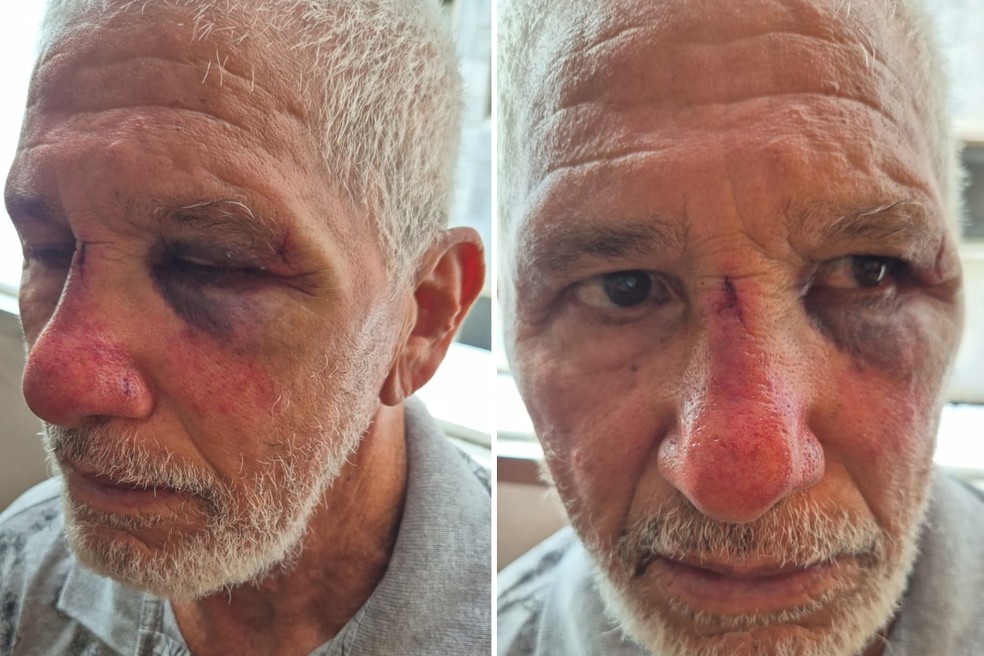 Aposentado, de 78 anos, foi agredido por motorista de veículo de luxo em Praia Grande, SP — Foto: Arquivo Pessoal