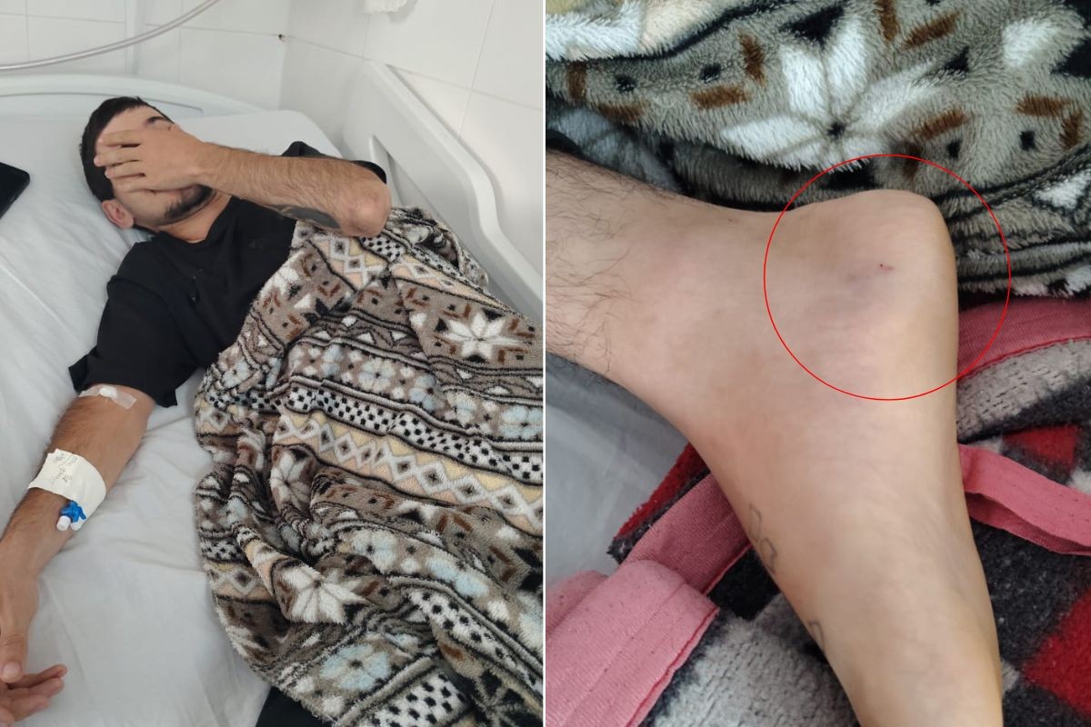Motoboy é mordido por cobra e internado no litoral de SP