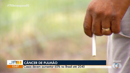 Saiba por que os homens estão mais suscetíveis ao câncer do pulmão