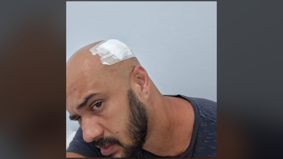 Motorista de app diz ter sido agredido por cliente com chave de roda ao se negar a transportar pneu velho e sujo