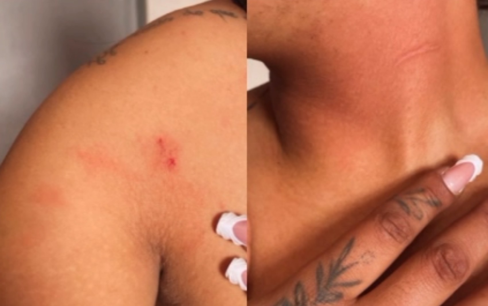 Confusão no trânsito termina em agressão contra motogirl e depredação de casa em Poços de Caldas, MG
