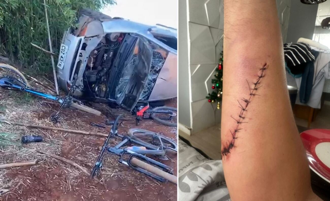 Ciclista atropelado com outros três levou 15 pontos no braço; prejuízo com acidente passa de R$ 20 mil 