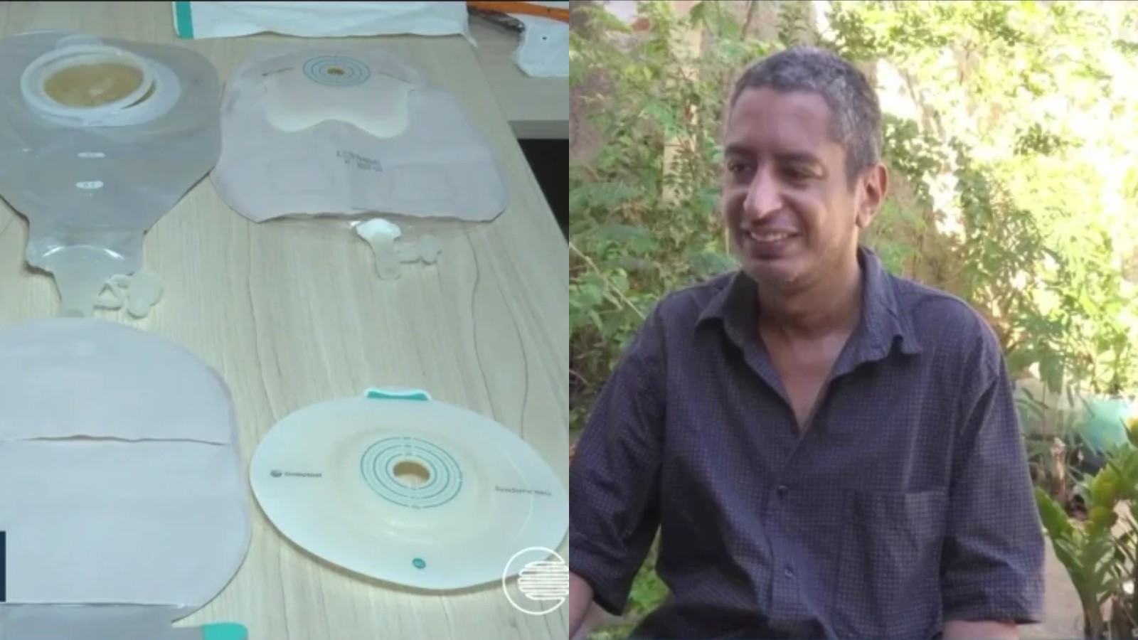 Bolsas de ostomia: pacientes da rede municipal de saúde de Teresina relatam falta de abastecimento e má qualidade dos dispositivos