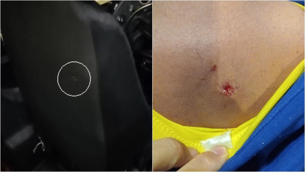 Motorista de ônibus ficou ferido após ser atingido de raspão nas costas por tiro durante assalto a ônibus em Fortaleza. — Foto: Reprodução