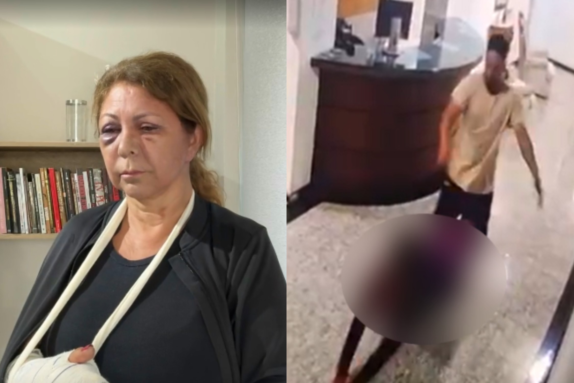 Antes de cometer agressão, hóspede convidou recepcionista para ir ao quarto dele em hotel de Curitiba
