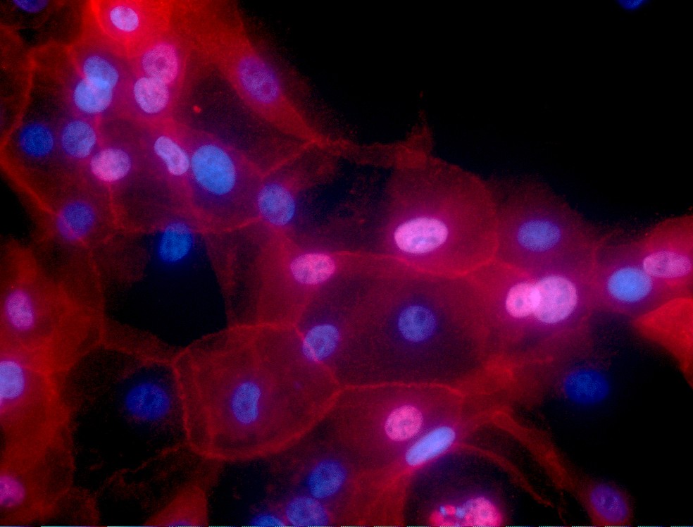 Cultura de células de câncer de mama vistas em microscópio eletrônico. — Foto: Ewa Krawczyk, National Cancer Institute/Georgetown Lombardi Comprehensive Cancer Center