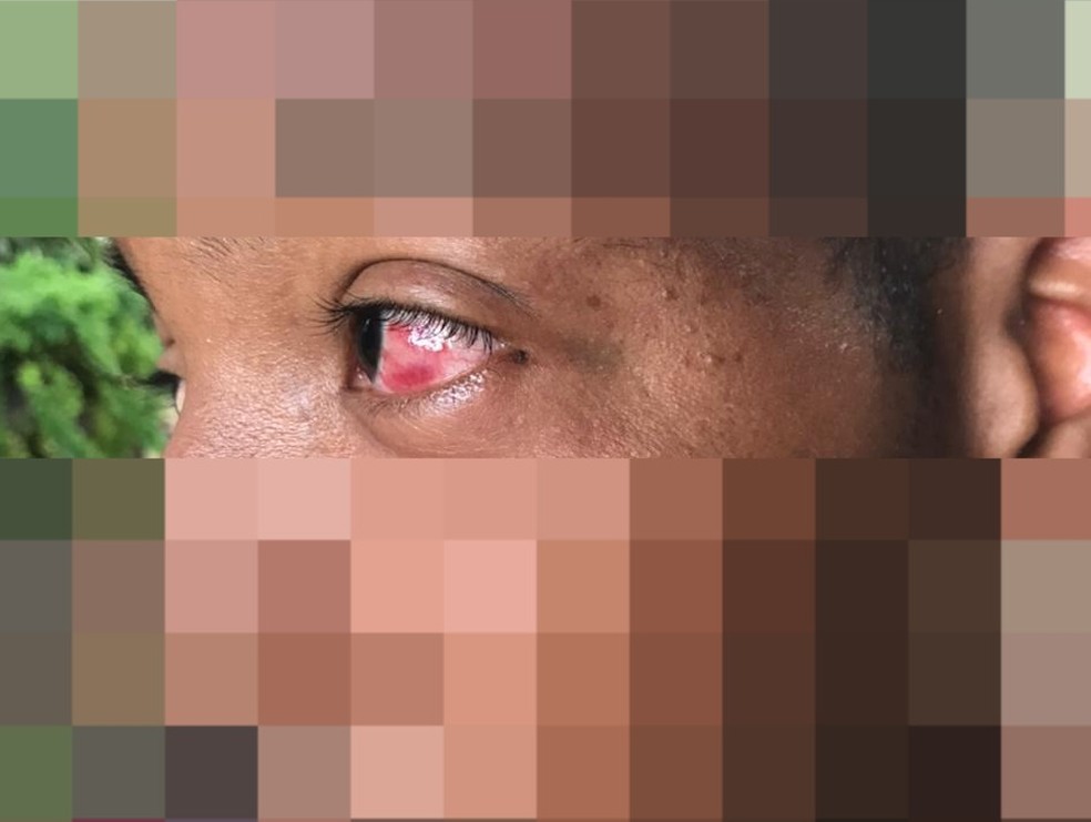 Estudante é retirado de escola e torturado em matagal no interior do PI; vítima denuncia dois policiais — Foto: Reprodução