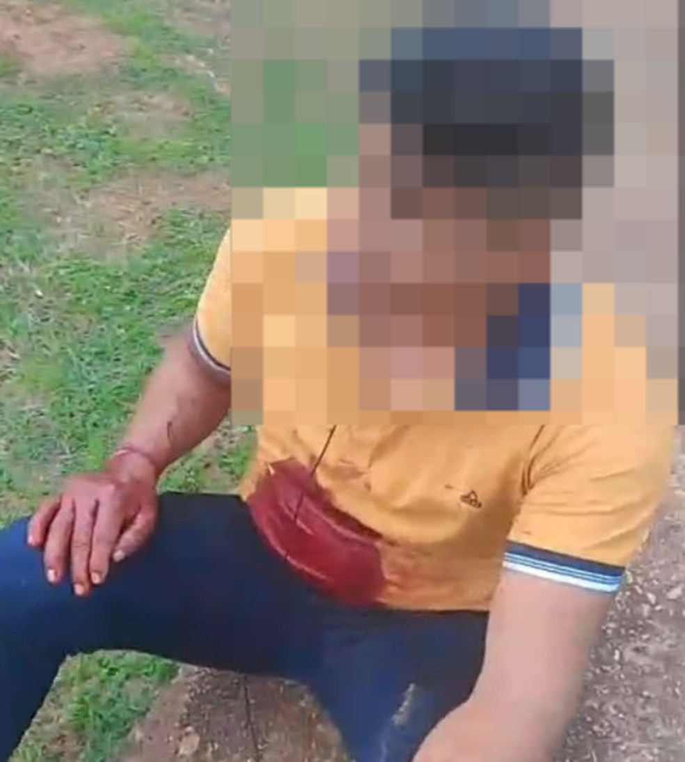 Dois indígenas parakanã são baleados em atentado próximo à Terra Indígena Apyterewa, no Pará. — Foto: Reprodução