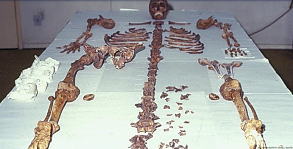 Ossos de Mengele viraram objeto de estudo na USP — Foto: Daniel Romero Muñoz/courtesy/DW