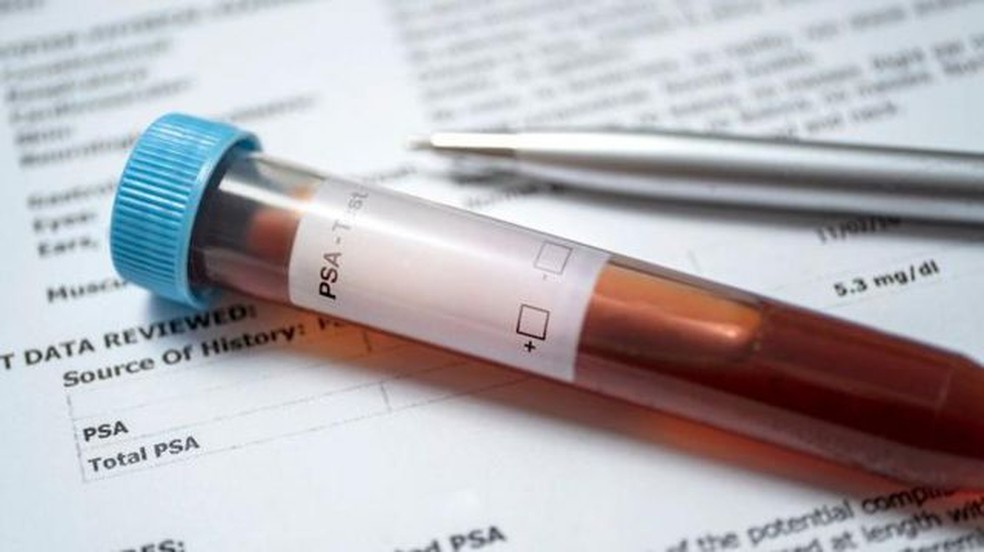 O PSA é uma enzima que pode ser medida pelo sangue e ajuda a entender se há algo de errado na próstata. — Foto: GETTY IMAGES via BBC