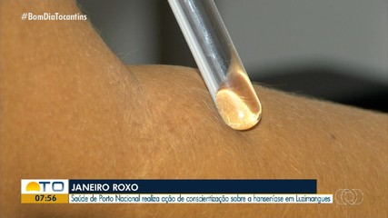 Campanha Janeiro Roxo leva ação de conscientização sobre hanseníase para Luzimangues