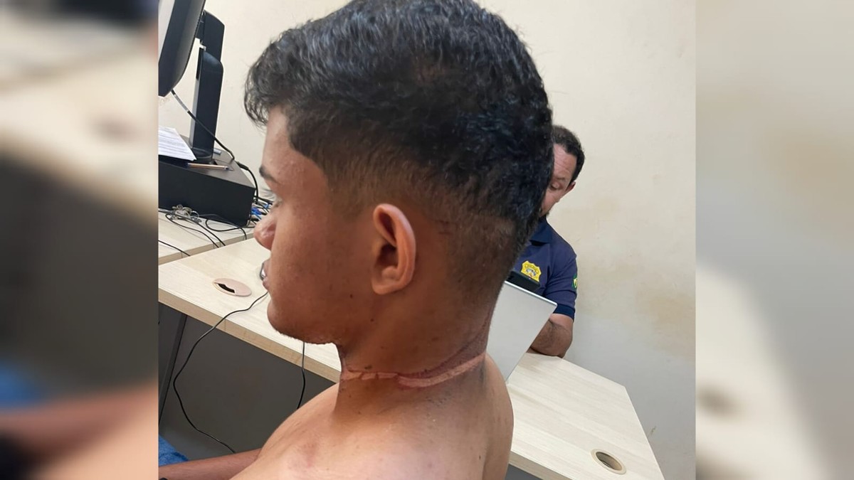 VÍDEO: Motociclista sofre cortes no pescoço provocados por cabos de  internet, em Rurópolis, Santarém e Região