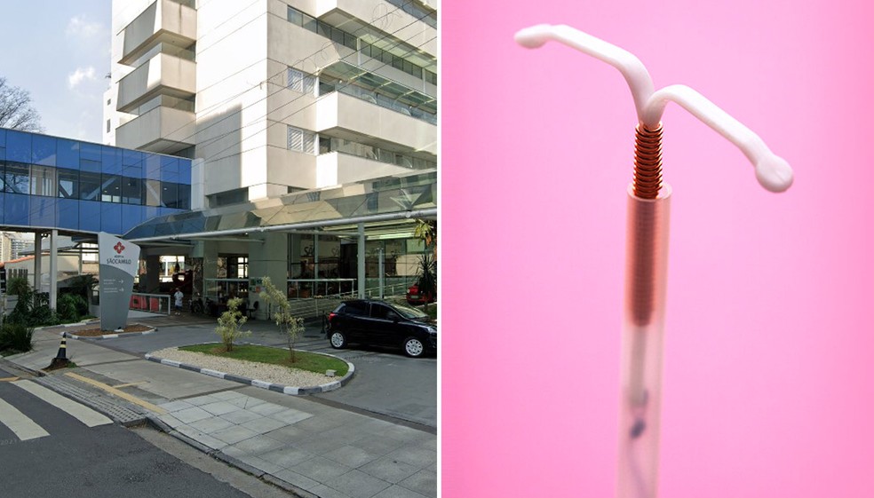Montagem com a fachada do hospital São Camilo, em São Paulo, e uma imagem ilustrativa de um DIU. — Foto: Google Street View e Reprodução