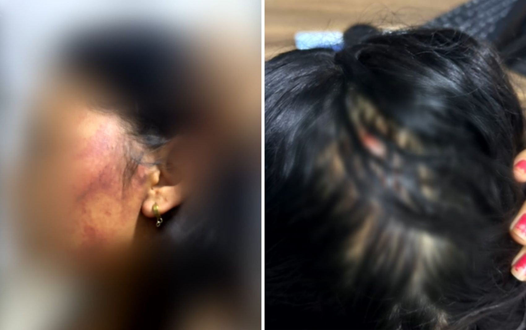 Mulher pula de moto em movimento para se salvar após ser estuprada e espancada, diz polícia