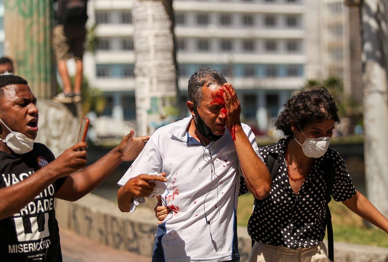 Estado é condenado a indenizar em R$ 300 mil trabalhador que ficou cego de um olho após ser atingido por bala de borracha em protesto no Recife