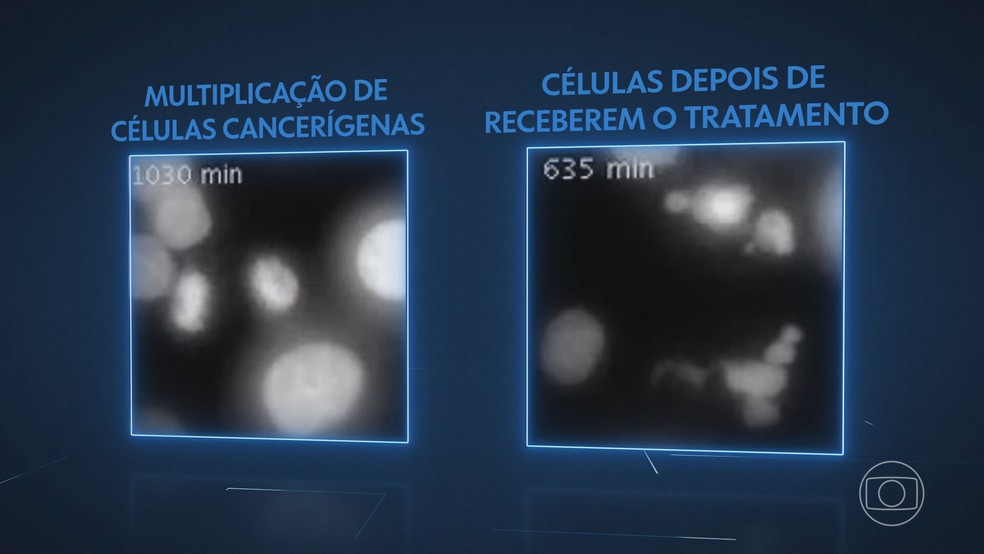Imagens de microscópio mostram como células de câncer normalmente se multiplicam — Foto: Reprodução/TV Globo