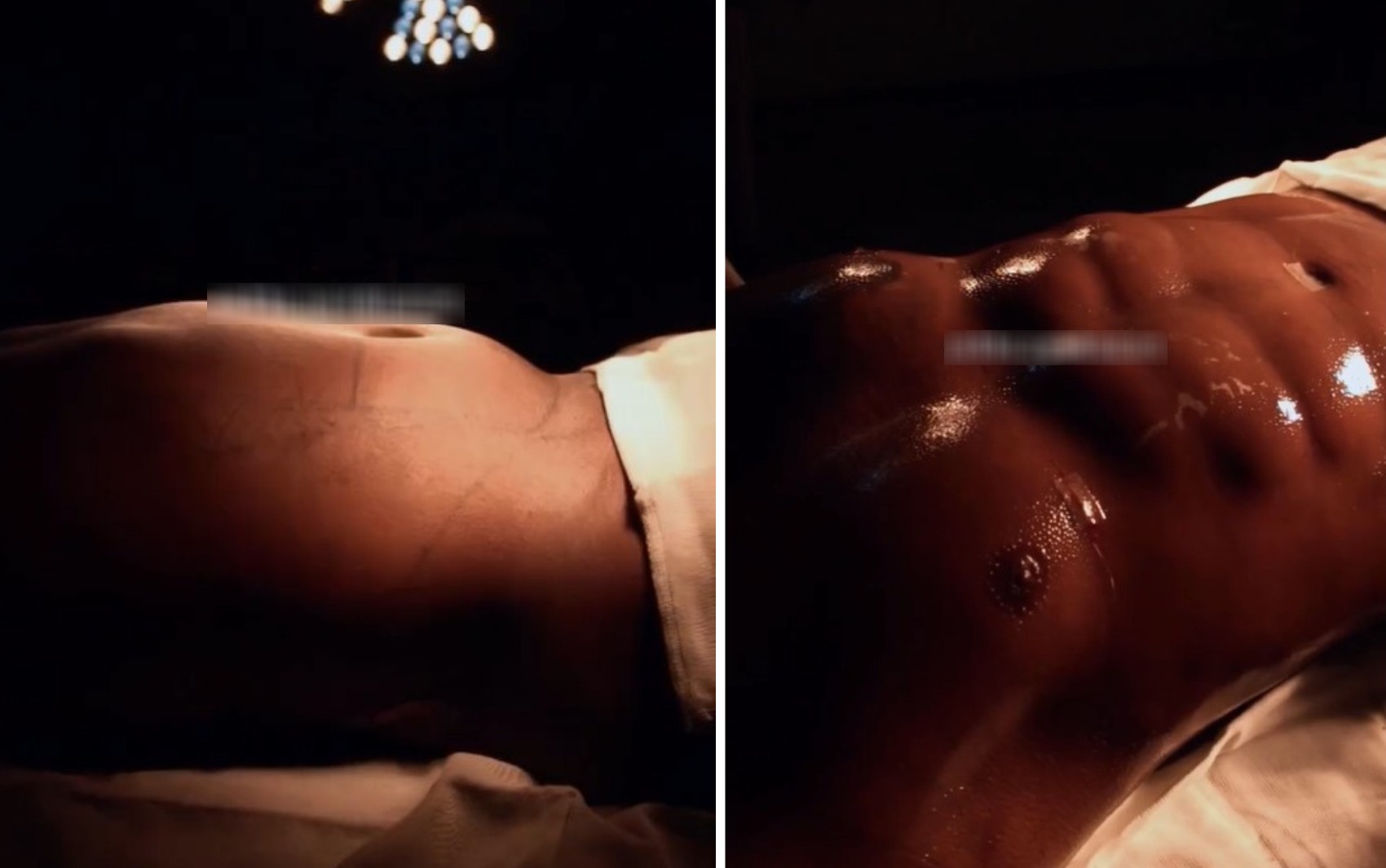 Davi Brito Reaparece na Web Após Cirurgia e Mostra Resultado de Lipo HD; Veja Antes E Depois | Bahia