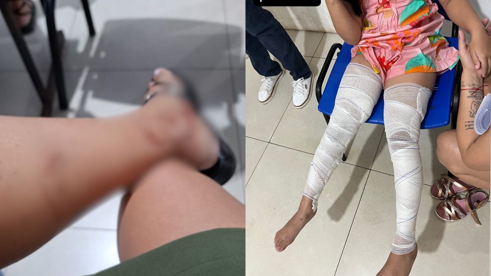 Outras pessoas ficaram feridas com o incidente &mdash; Foto: Reprodu&ccedil;&atilde;o/Redes Sociais