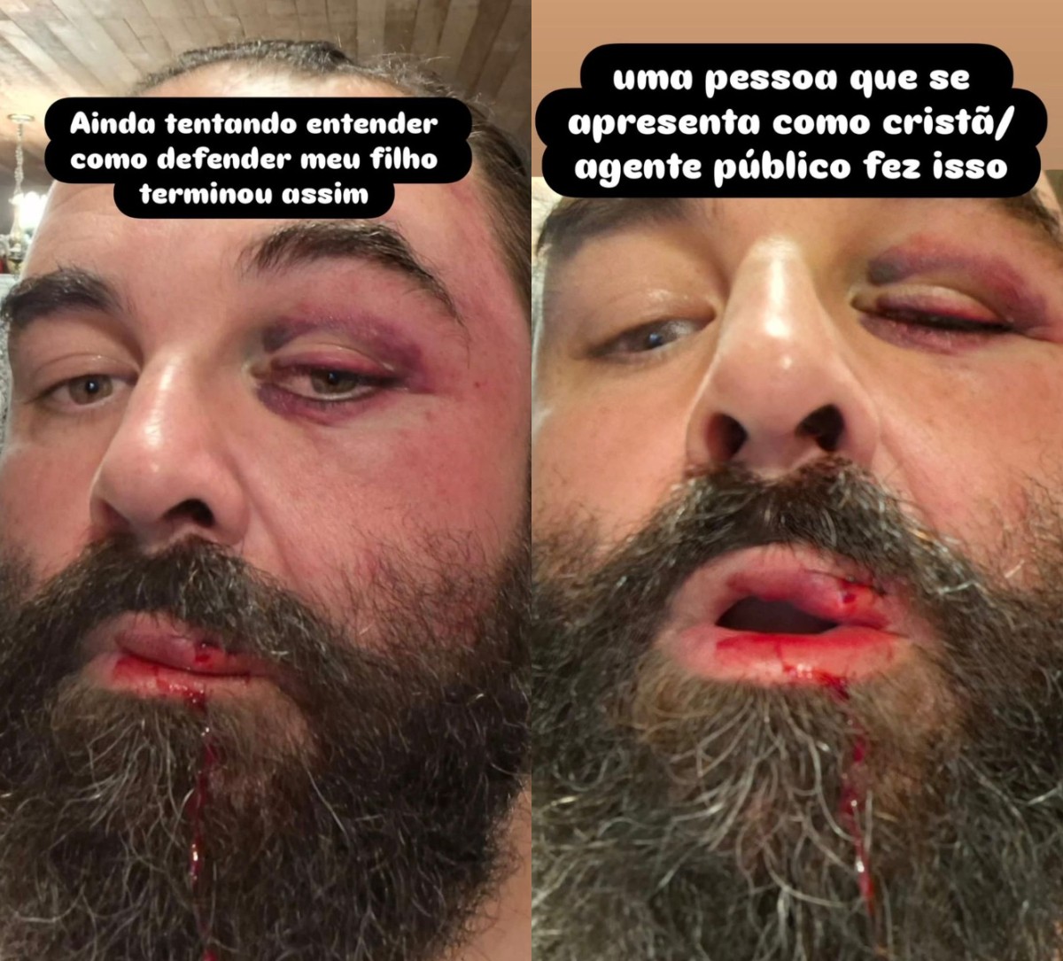 'Caí desacordado', diz homem que levou socos de guarda de folga ao reclamar de som alto em igreja de SC